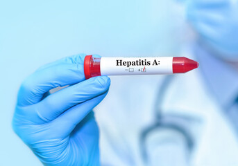 Doctor holding a test blood sample tube positive with hepatitis A virus (HAV) test. Banner. Copy space