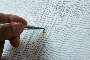 Doctor pointing at EEG of abnormal brain waves