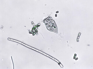 Freshwater aquatic zooplankton and algae under microscope view