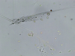 Diatoms, algae under microscopic view, phytoplankton, fossils, silica, golden yellow algae