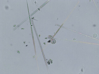 Diatoms, algae under microscopic view, phytoplankton, fossils, silica, golden yellow algae