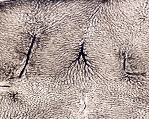Liver. Blood vessels labelled with Indian ink