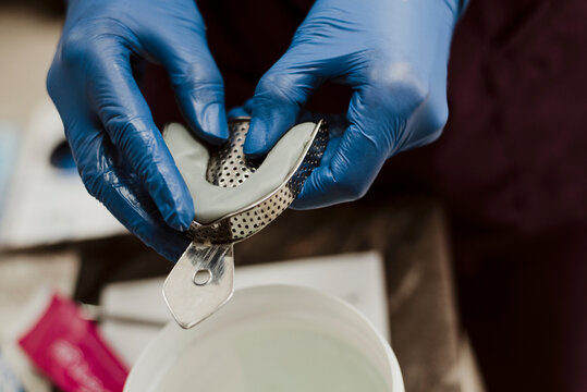 Preparing for dental impressions