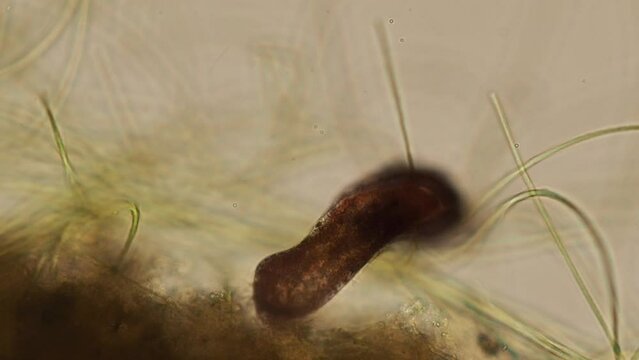 ciliated flatworm Turbellaria under the microscope - optical microscope x400 magnification