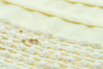 Close-up view of the dirt stains on the clothes.