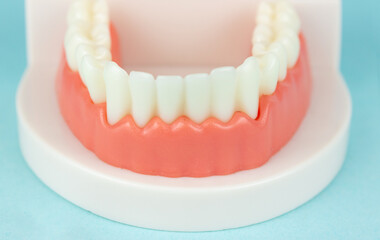 Dental prosthesis on blue background, close-up. Old age. Teeth. Jaw. Close-Up Of Dentures Against Blue Background. Denture picture with focus on teeth on blue background.