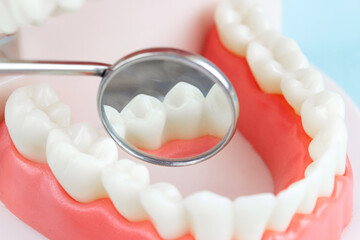 Prosthetic dentistry. Advertising. Removable denture. Dentist appointment Close-Up Of Dentures Against Blue Background. Denture picture with focus on teeth on blue background.