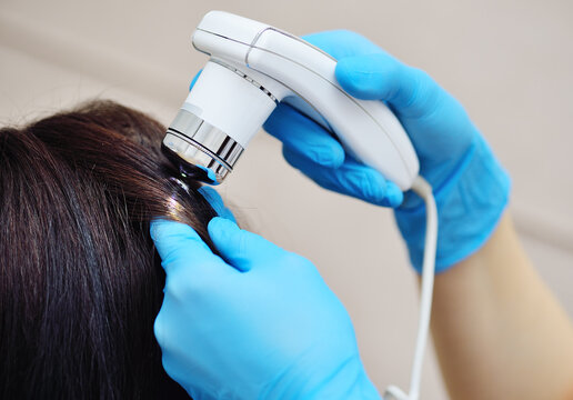 doctor cosmetologist dermatologist diagnoses the condition of the patient's hair using a special device - a trichoscope.