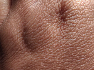 Fototapeta premium Hand skin texture, with dehydration, dryness, signs of age, mature skin, close up.