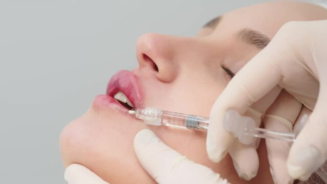 close-up, female lips. Surgeon, in medical gloves, carefully and slowly injects hyaluronic acid into woman's lips with a syringe. lip augmentation procedure. beauty injections. Plastic surgery.