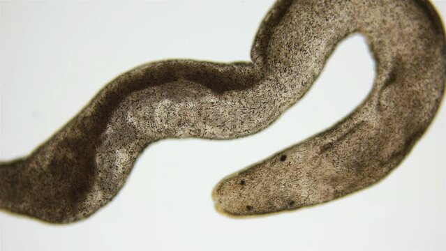 Nemertea worm under a microscope, class Hoplonemertea, order Monostilifera. Possibly family Tetrastemmatidae. Sample was found in White Sea.