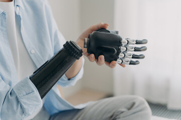 Artificial hand and arm with wrist joint. Disabled woman disassembling high technology prosthesis.