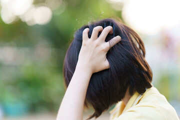 Woman scratching her head due to yeast infection or dandruff on her scalp. Health care concept. - obrazy, fototapety, plakaty