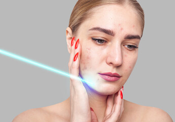 Woman getting facial laser polishing face procedure.