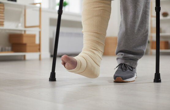 Person with a broken leg walks with crutches. Unrecognizable young man with an injured leg in a bandage walking with crutches in the room at home. Close up of human feet on the floor. Injury concept