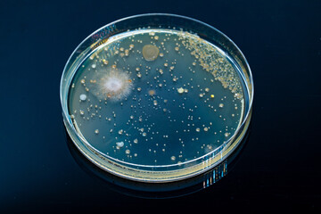 Petri dish with colonies of bacteria fungi on agar