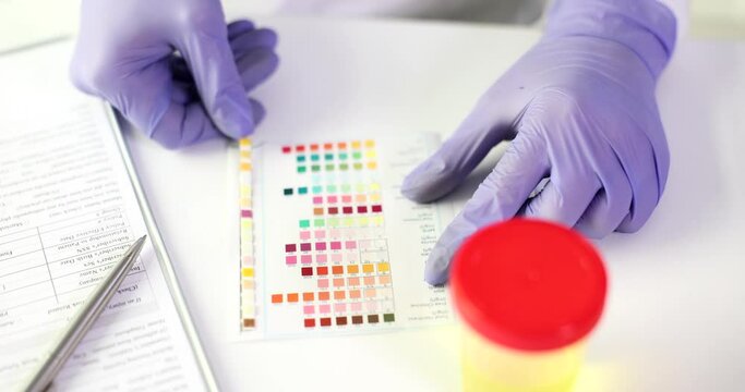 Doctor makes express urine test in laboratory