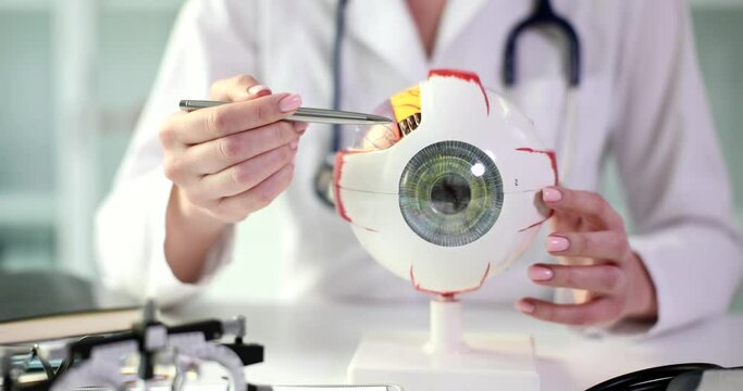 Ophthalmologist holds anatomical model of human eye