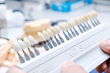 Close up of shade guide to check veneer of tooth crown in a dental laboratory