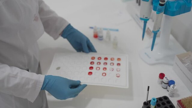 Center for lifeblood donation. Blood transfusion clinic. Plasma donation. Blood type and rh factor testing by agglutination method. Plastic blood palette in process HIV testing by agglutination method