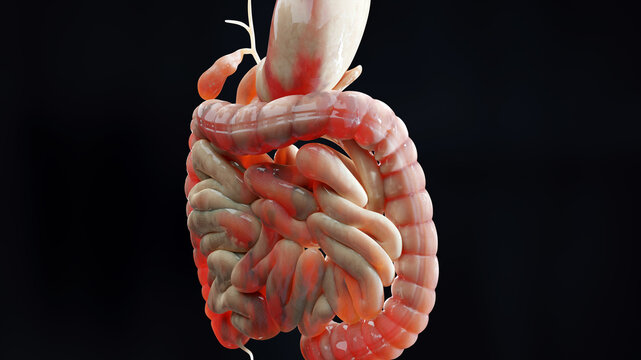man suffering from crohns disease, male anatomy, inflamed large intestine, Sigmoid Colon, human digestive system parts, 3d render