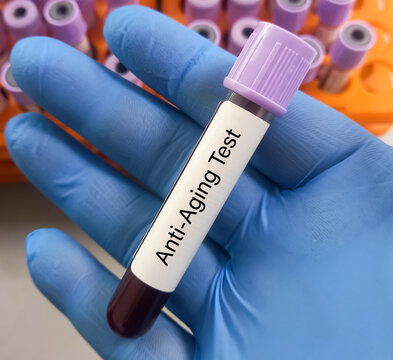 Blood sample for anti-aging test, anti-aging blood tests to pinpoint markers of aging.