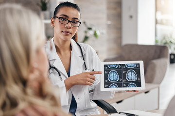 Brain, woman and doctor pointing at tablet, mri scan or xray diagnosis for cancer. Healthcare, advice and neurology patient in doctors office, help consulting on health problem for hospital treatment - obrazy, fototapety, plakaty