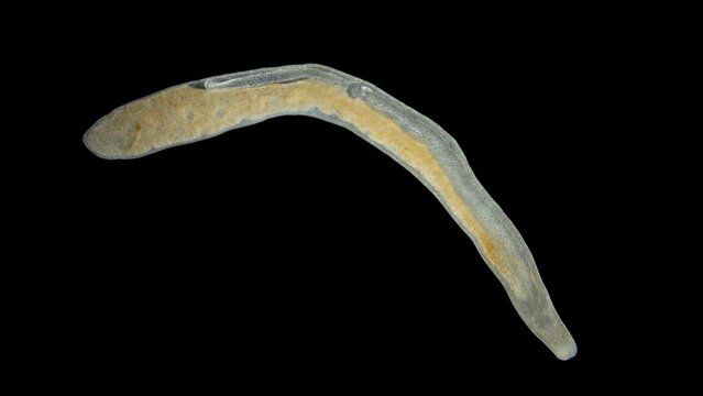 Nemertea worm under a microscope, class Hoplonemertea, order Monostilifera. Possibly family Tetrastemmatidae. Sample was found in White Sea.