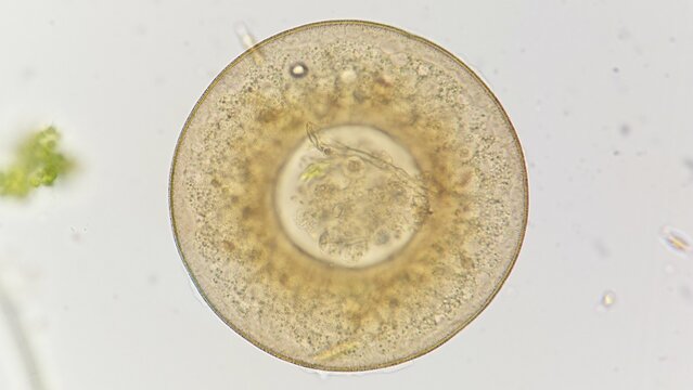 Testate amoeba, an amoeba with a smooth shell. Genus Galeripora. Lugol fixed sample. 400x objective. selective focus