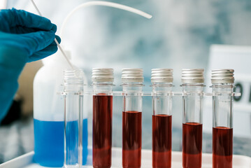 Testing in laboratory concept - Blood sample tubes