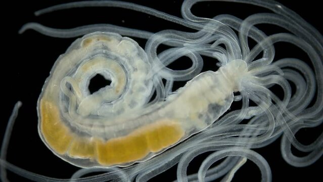 Worm Polychaeta, family Terebellidae under the microscope. Sample found in the White Sea