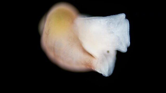 Young mollusca under a microscope, Oenopotinae subfamily, class Gastropoda. Size 0,7 mm. White Sea.