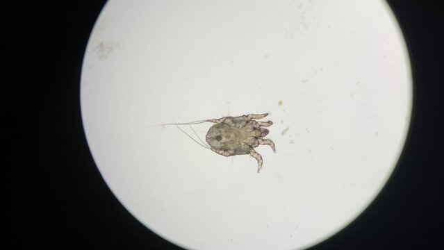 Otodectes cynotis, or ear mites under the microscope. This mites are found in cat's ear.