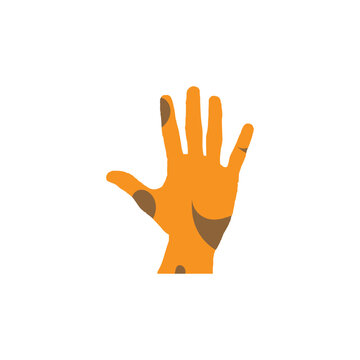 Leprosy hand icon. World leprosy day poster symbol.