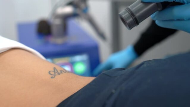 Girl erasing tattoo of exboyfriend name, deleting or removing. Dermatologist clinic tatto erase professionaly.