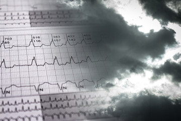Electrocardiogram tracing that ends in clouds. Passage to heaven or the afterlife.