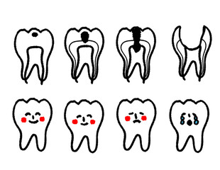 虫歯の進行　歯の気持ち