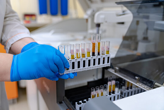 Scientific laboratory for blood researching. Analysing biochemistry equipment.