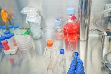 The researcher using glass Pasteur Pipette can be used for toxic reagents or other solution by sterile method.