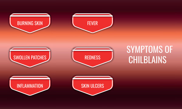 symptoms of Chilblains. Vector illustration for medical journal or brochure.
