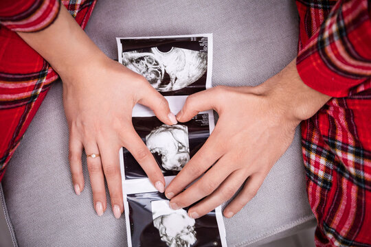 Parents-to-be arrange their hands in the shape of a heart on a baby's usg photo.