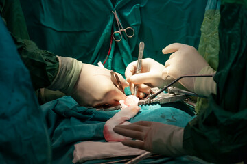 Surgeons performing open heart surgery
