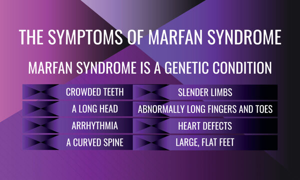 the symptoms of Marfan syndrome. Vector illustration for medical journal or brochure.
