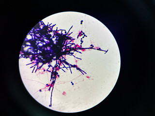 Budding yeast cell with pseudo hyphae.