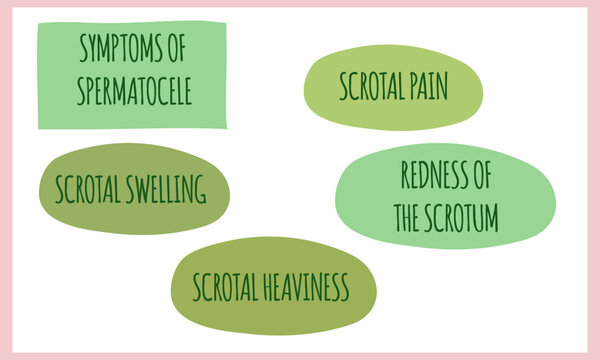symptoms of Spermatocele.  Vector illustration for medical journal or brochure. 