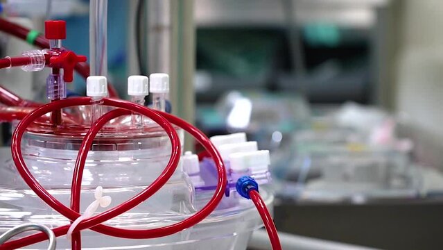 Heart-Lung Machine for heart surgery. Artificial blood-circulation apparatus. Cardiopulmonary bypass machine. Extracorporeal circulation machine. Blood pumping stock video.