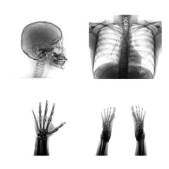 Many x-ray images of very good quality.