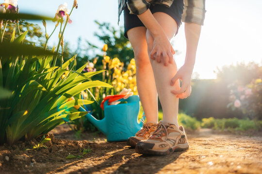 Woman scratches her leg, which is itchy from a mosquito bite. Close up of legs. Summer garden on the background. Allergies and insect bites concept