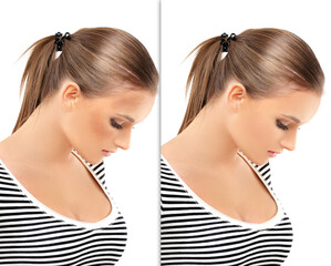 Dark spots, freckles,hyperpigmentation(melasma or chloasma),concept - skin lightening, skin whitening, fruit acids,AHA, Skin Brightening