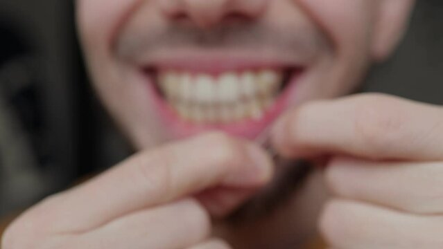 Young man pulls orthodontic rubber band on his teeth to correct his bite. Dental concept.